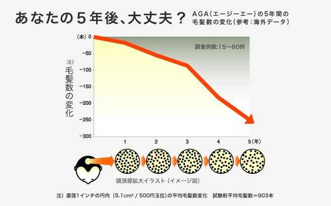 AGAの方の毛髪数の変化のグラフ