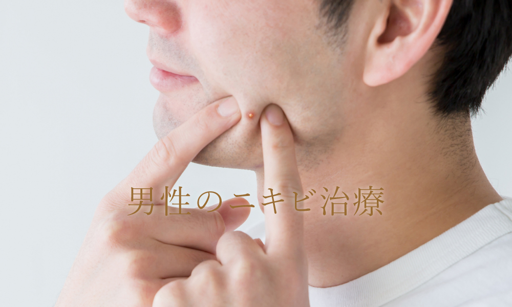 男性のニキビ治療について