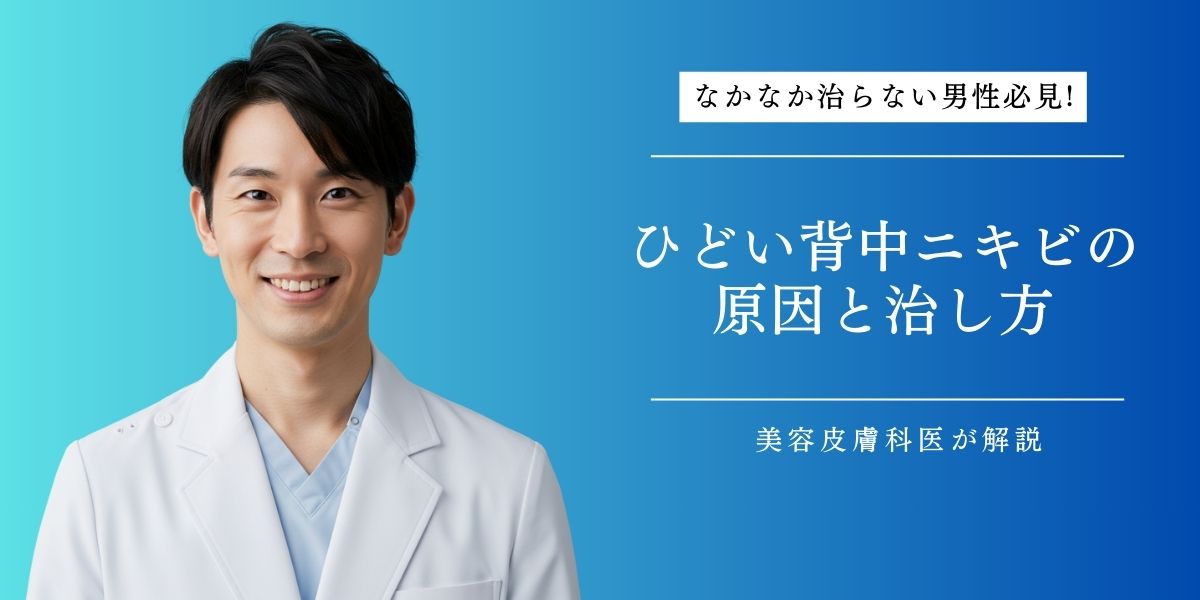 男性のひどい背中ニキビの原因と治し方