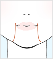 口横のマリオネットラインが目立つ女性