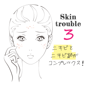 美肌治療で大阪ならPSCで肌のトラブルチェック　Skin Trouble3　ニキビとニキビ跡がコンプレックス