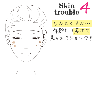 美肌治療で大阪ならPSCで肌のトラブルチェック　Skin Trouble4　しみとくすみ、年齢より老けて見られてショック！