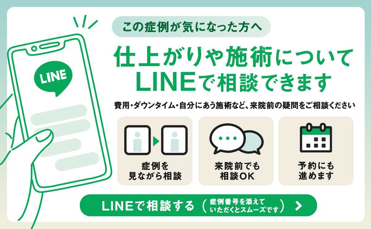 仕上がりや施術について LINEで相談できます