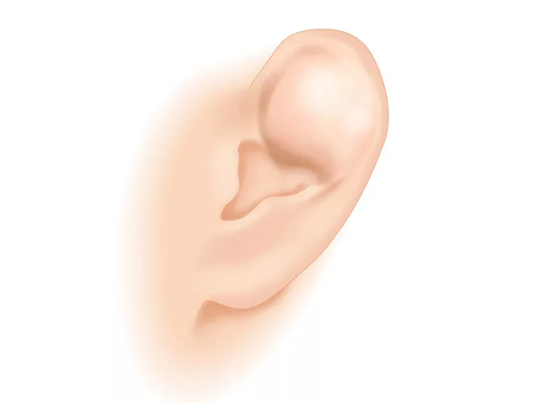 耳介形成術 耳の整形 大阪の美容外科プライベートスキンクリニック