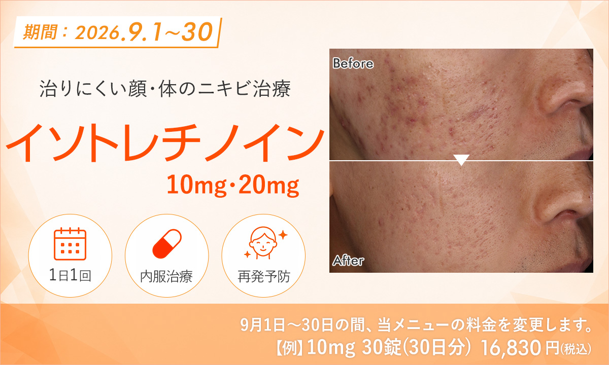 9月おすすめメニュー！イソトレチノイン