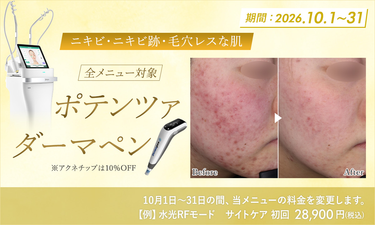 10月おすすめメニュー!ポテンツァ・ダーマペン