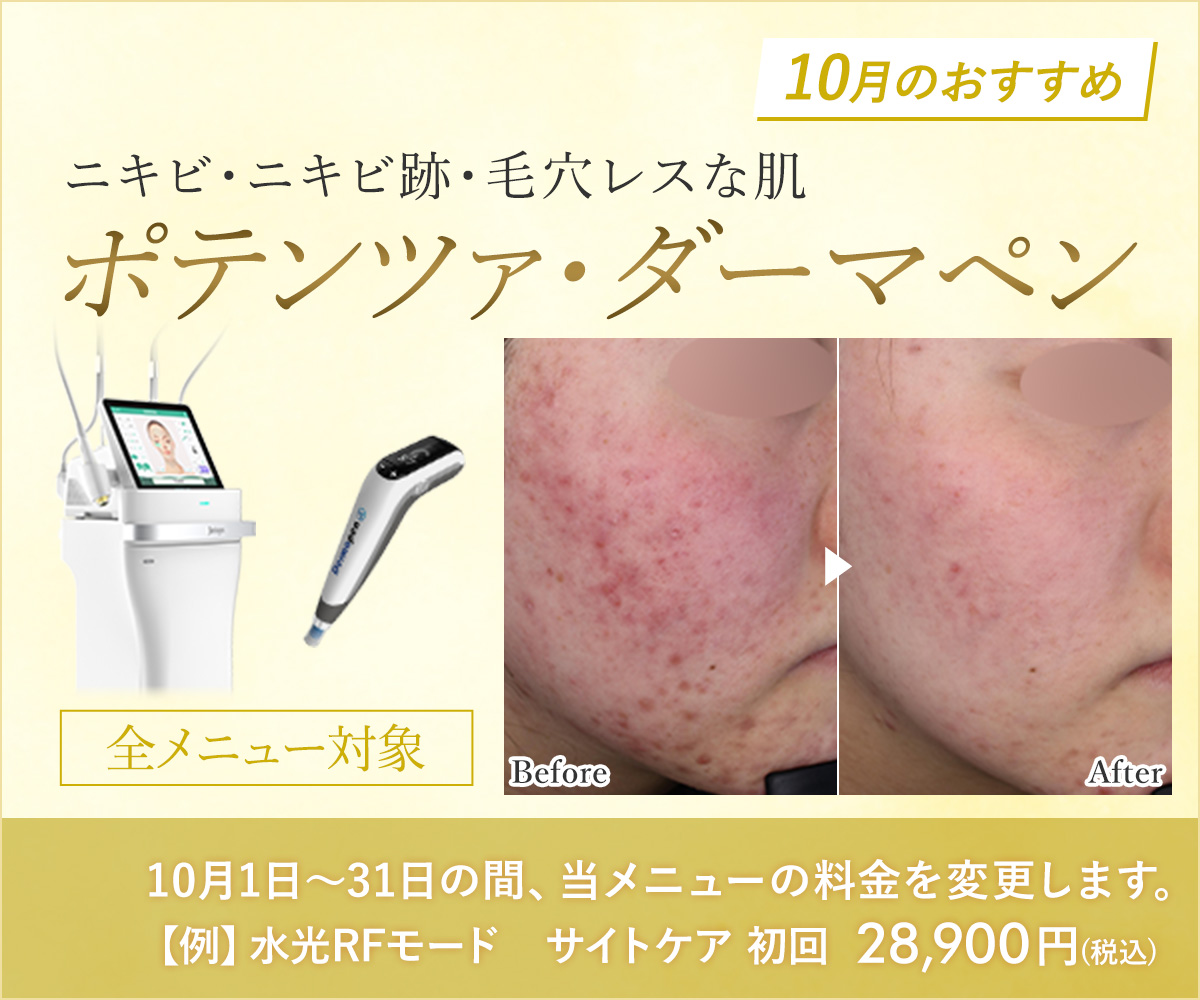 10月おすすめメニュー！ポテンツァ・ダーマペン
