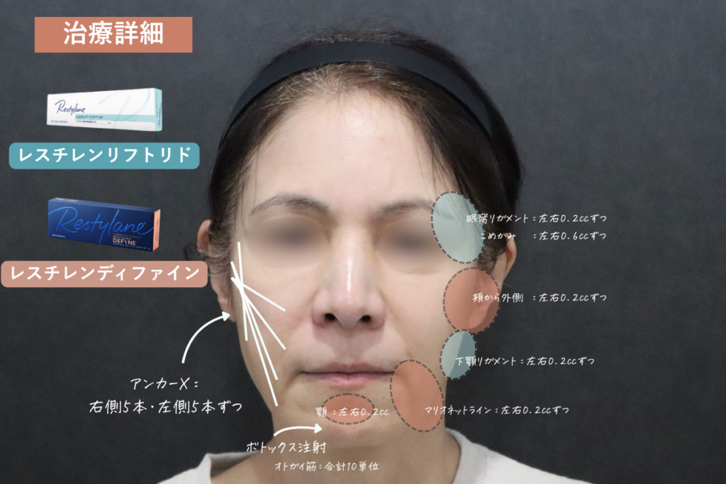 治療詳細