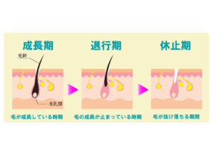 毛根断面歴史