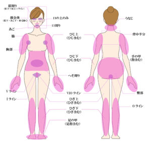 脱毛部位画像