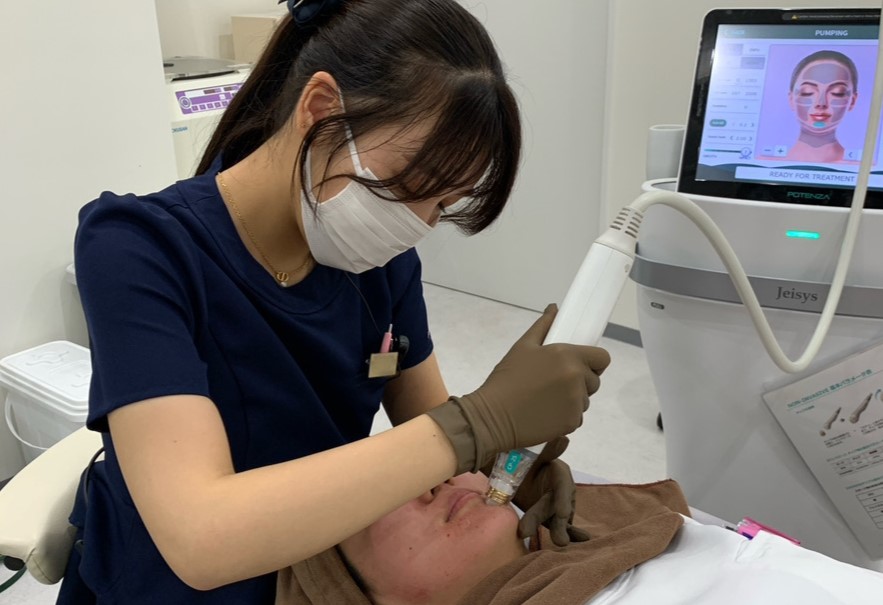 ジュベルックｘポテンツァの施術効果