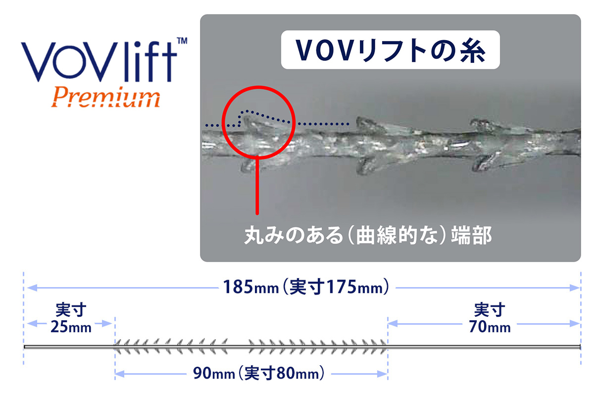 VOVリフトについて