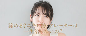 諦める？ニキビ跡クレーターは一生治らない？