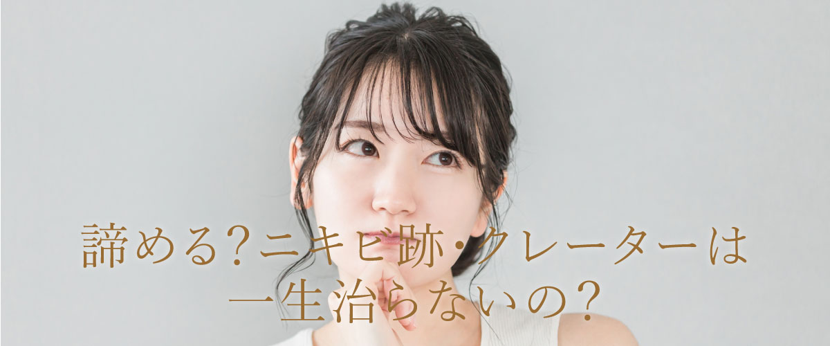 ニキビ跡・クレーターは一生治らない?