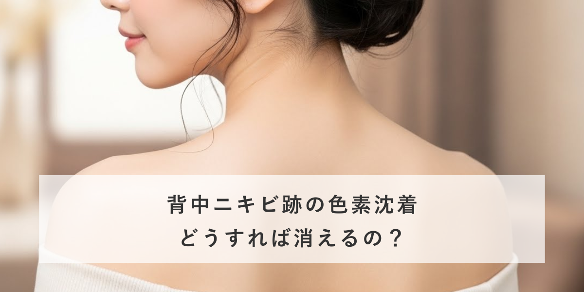背中ニキビ跡の色素沈着を消す方法を美容皮膚科医が解説
