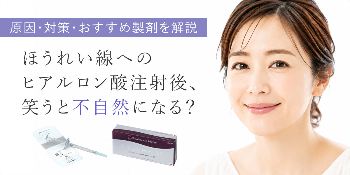 ほうれい線へのヒアルロン酸注射後、笑うと不自然になる？原因・対策・おすすめ製剤を解説
