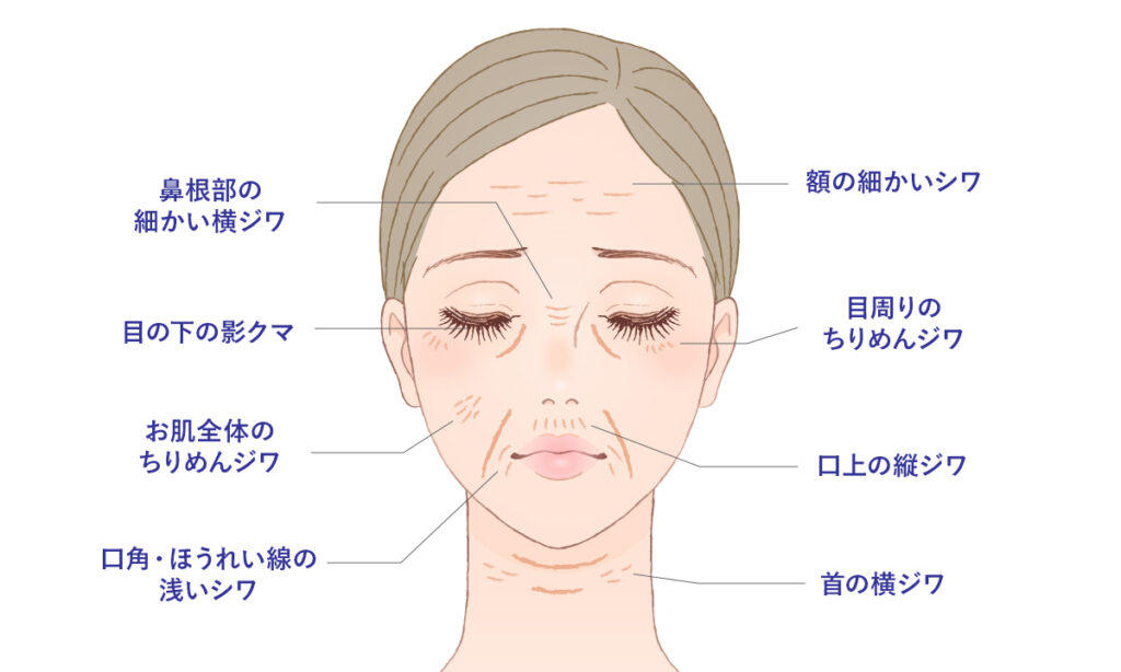 ベビーコラーゲンのおすすめ治療部位