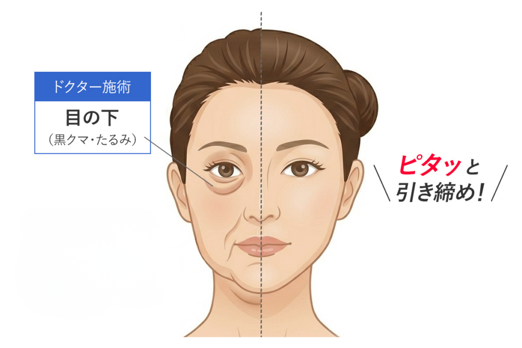 モフィウス8が適しているクマの種類