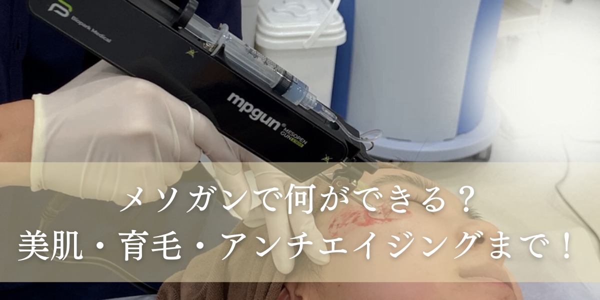 メソガンの特徴や効果、ダウンタイムまで詳しく解説しま す!