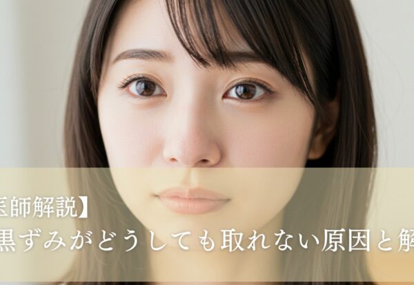 【医師解説】鼻の黒ずみがどうしても取れない原因と解決法