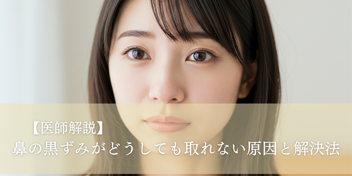 【医師解説】鼻の黒ずみがどうしても取れない原因と解決法