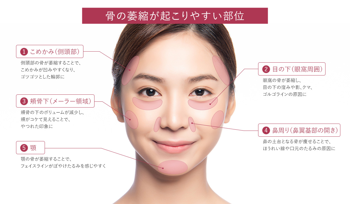 骨の萎縮が起こりやすい部位