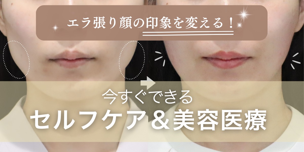 エラ張り顔の印象を変える!今すぐできるセルフケア&美容医療