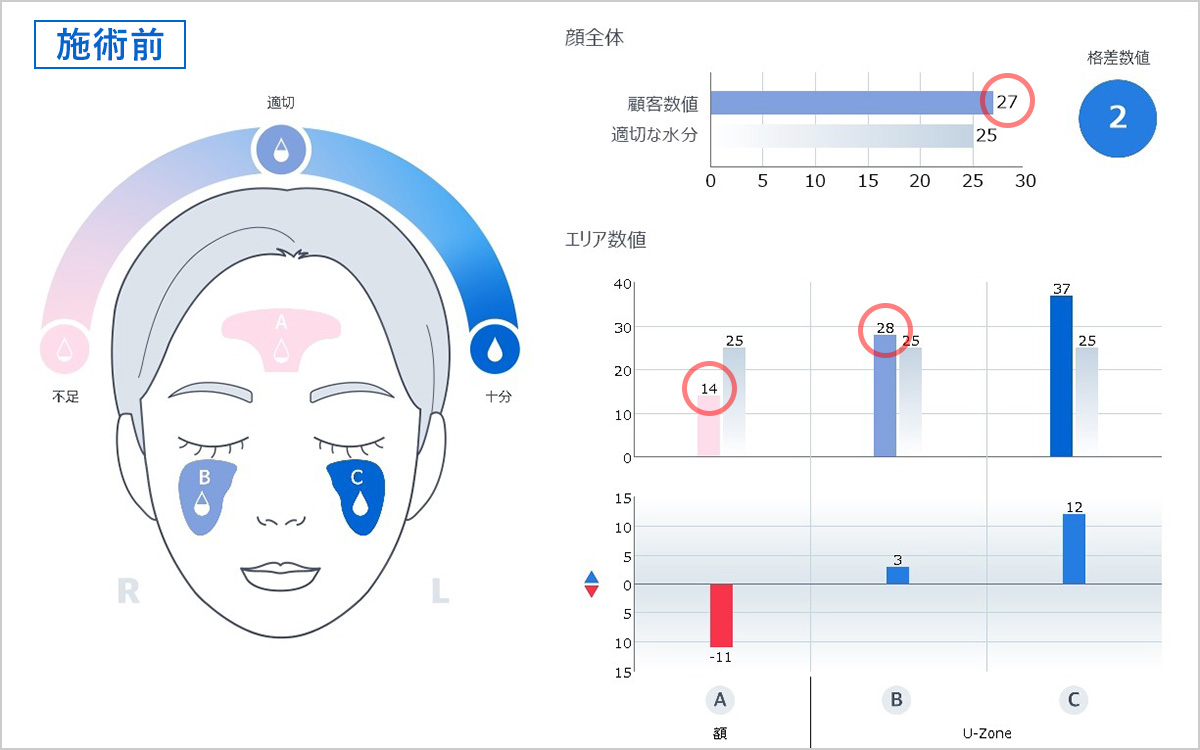 プルリアル デンシファイ施術前の水分量