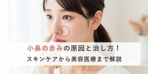 小鼻の赤みの原因と治し方！スキンケアから美容医療まで解説