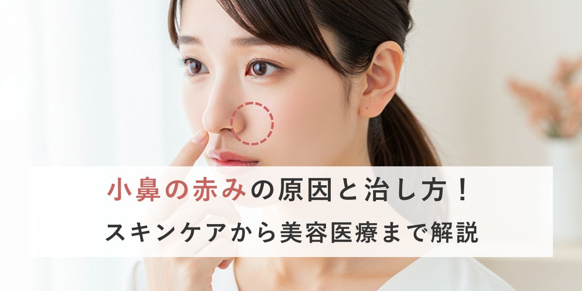 小鼻の赤みの原因と消す方法を解説します！