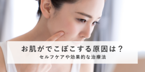 お肌がでこぼこする原因は？セルフケアや効果的な治療法は？