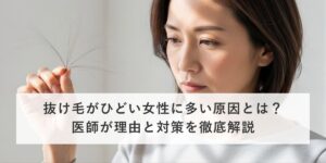 抜け毛がひどい女性に多い原因とは？医師が理由と対策を徹底解説