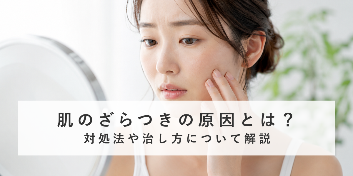 肌のざらつきの原因とは？対処法や治し方について解説