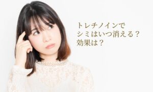 トレチノインでシミはいつ消える？効果は？