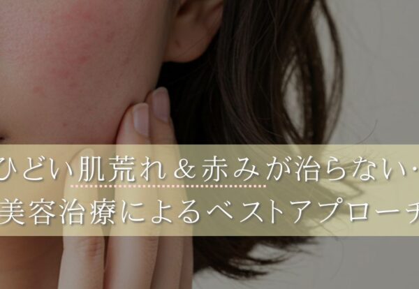 ひどい肌悩みを根本から治したい！赤み や肌荒れの原因と対処法を解説 