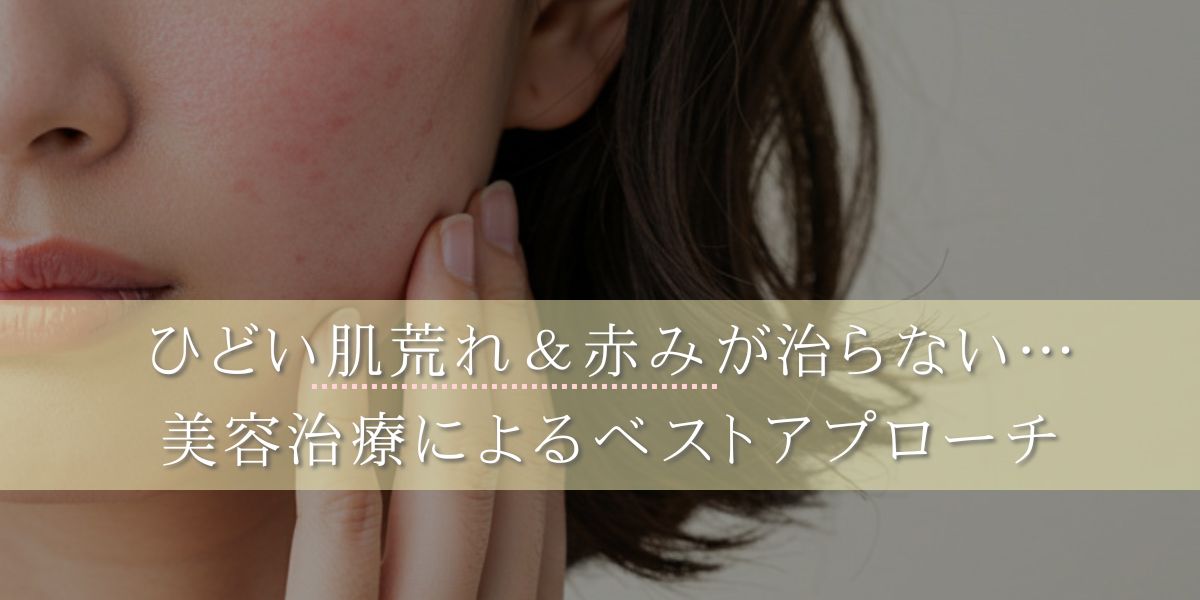 ひどい肌悩みを根本から治したい！赤みや肌荒れの原因と対処法を解説 