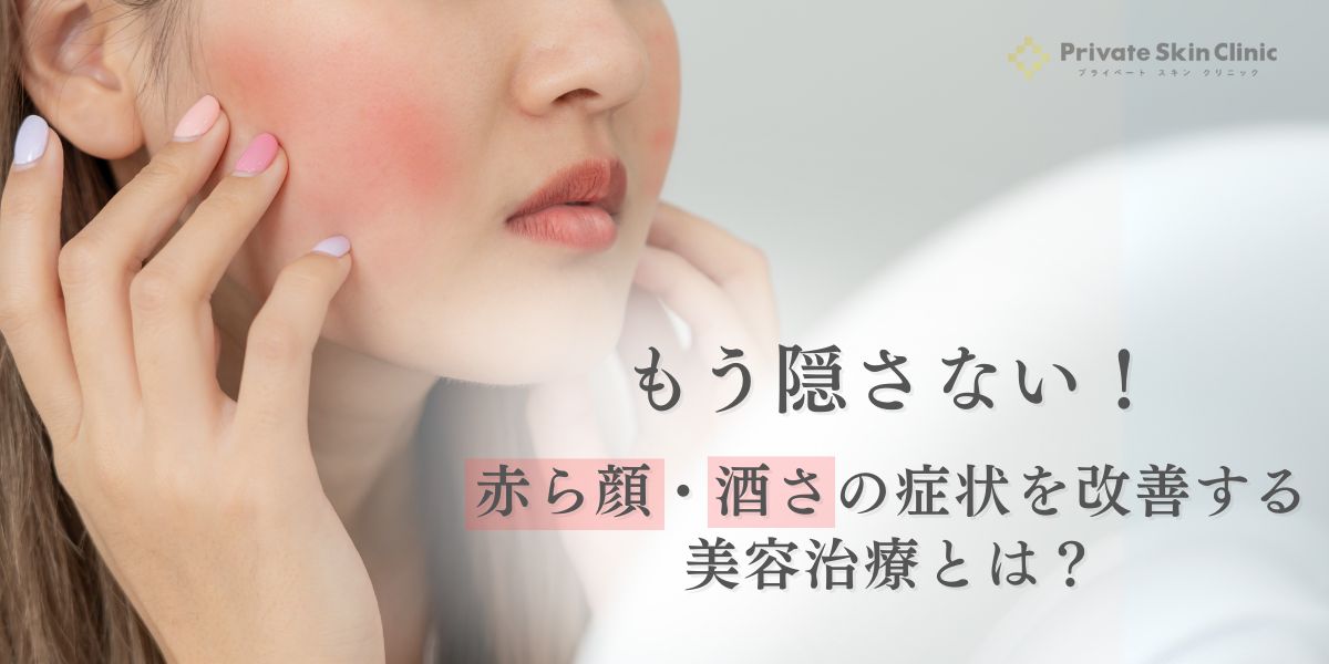 赤ら顔・酒さの症状を改善する美容医療とは
