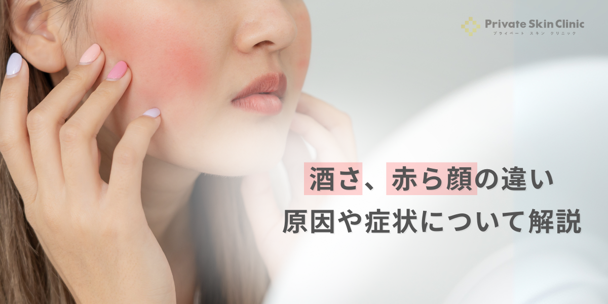 酒さ、赤ら顔の違い｜原因や症状について解説