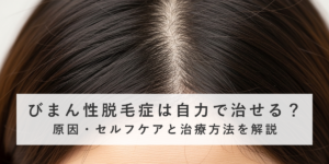 びまん性脱毛症は自力で治せる？原因・セルフケアと治療方法を解説