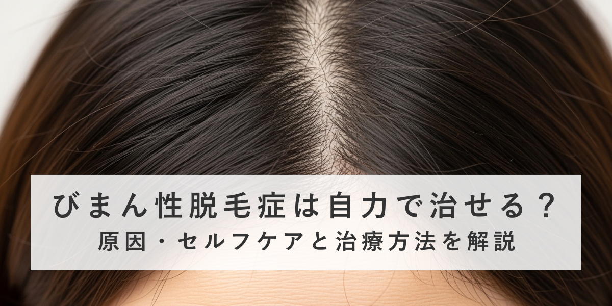 びまん性脱毛症は自力で治せる？