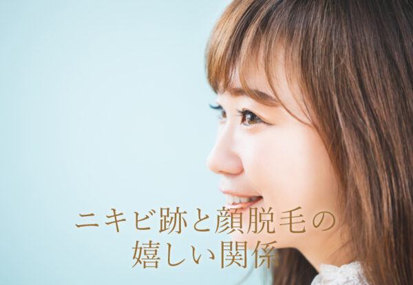 ニキビ跡と顔脱毛の嬉しい関係