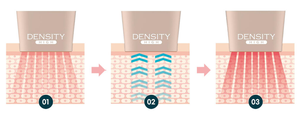 デンシティは本当に効果ある?科学的な仕組みから検証