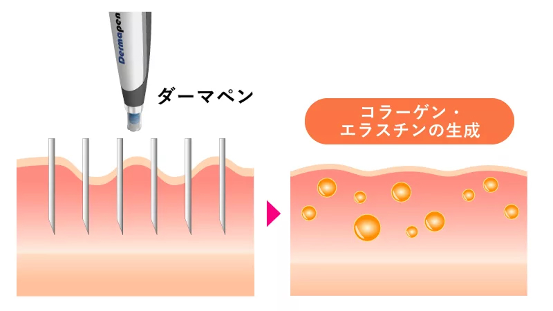 コラーゲンやエラスチンを産生