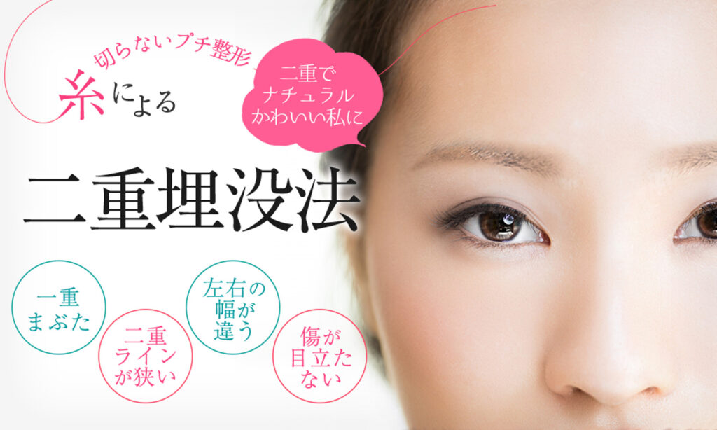 二重埋没法は糸による切らないプチ整形