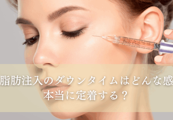 顔の脂肪注入のダウンタイムはどんな感じ？本当に定着する？