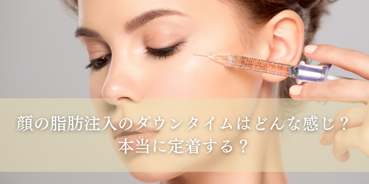 顔の脂肪注入のダウンタイムはどんな感じ?本当に定着する?