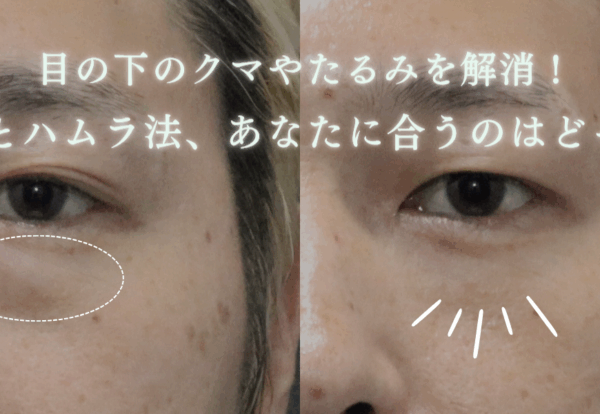 脱脂とハムラ法について徹底比較