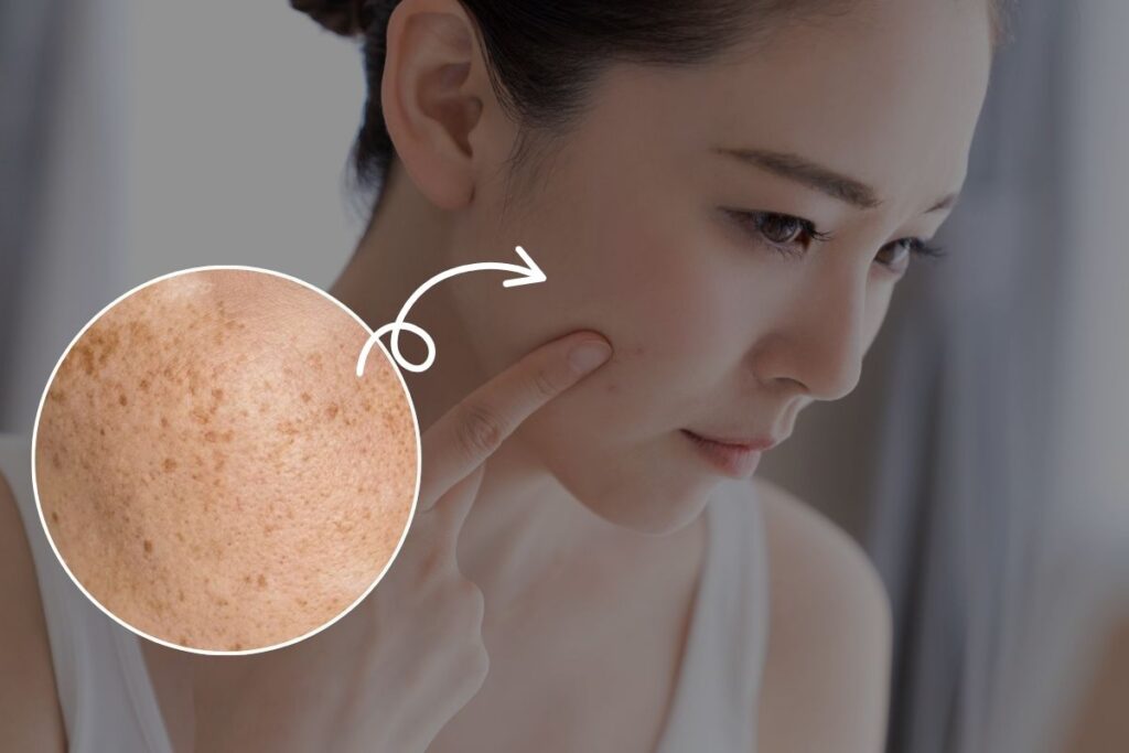 シミで効果が出にくい人の特徴