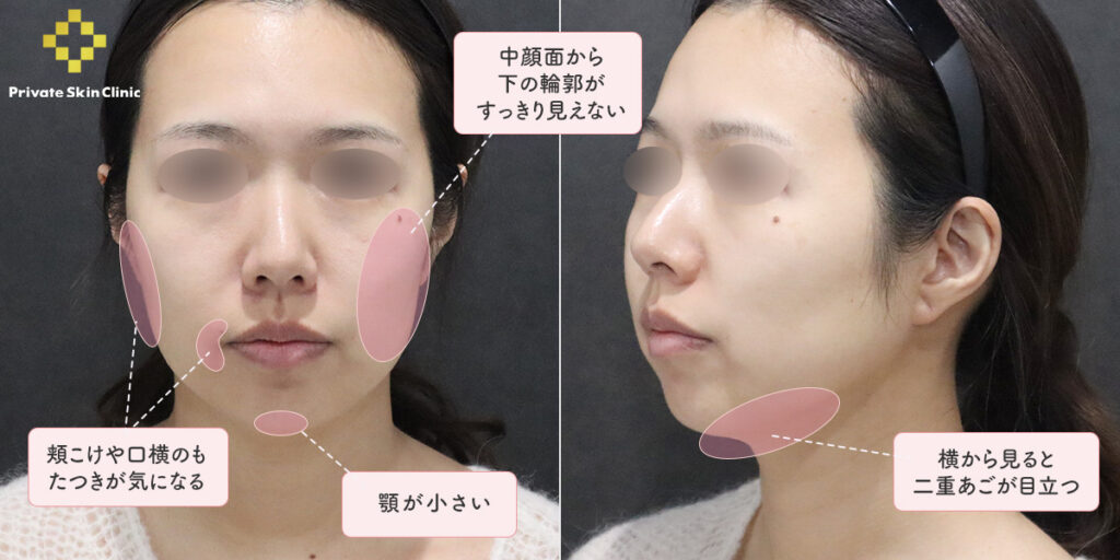 患者様が気にされていたポイント