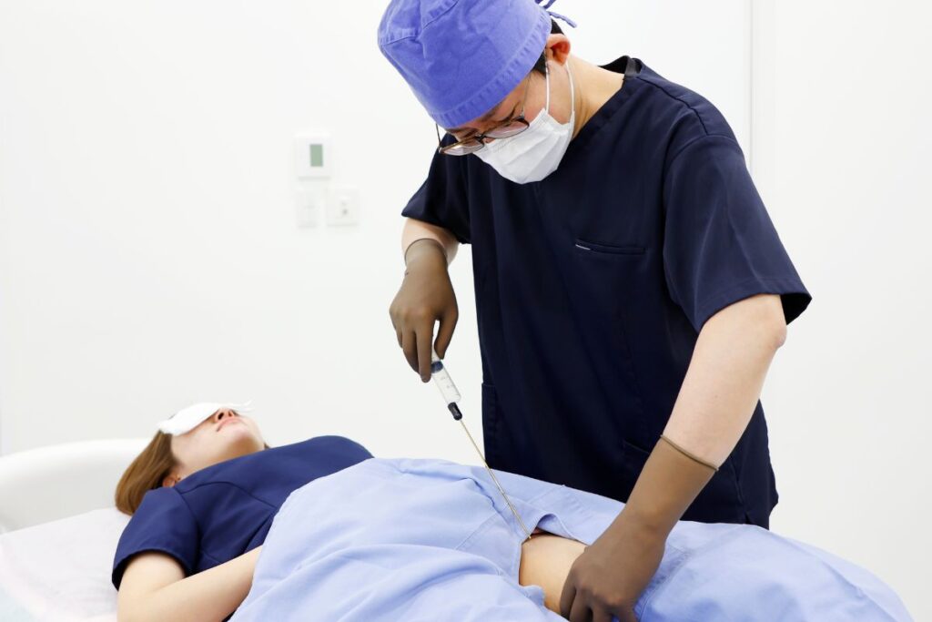 脂肪注入に使用する脂肪を太ももから採取する様子